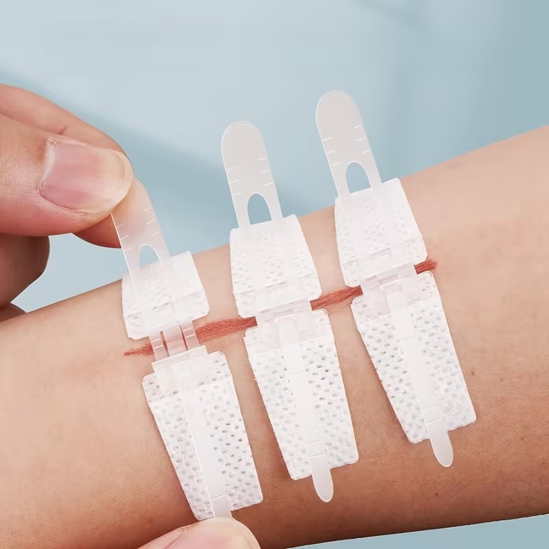 30 Pcs Emergency Wound Closure Bandage